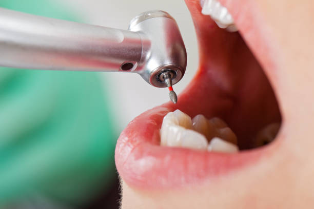 Best Emergency Dental Surgery in Emporia, KS